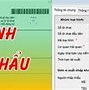 Mã Loại Hình H21 Là Gì